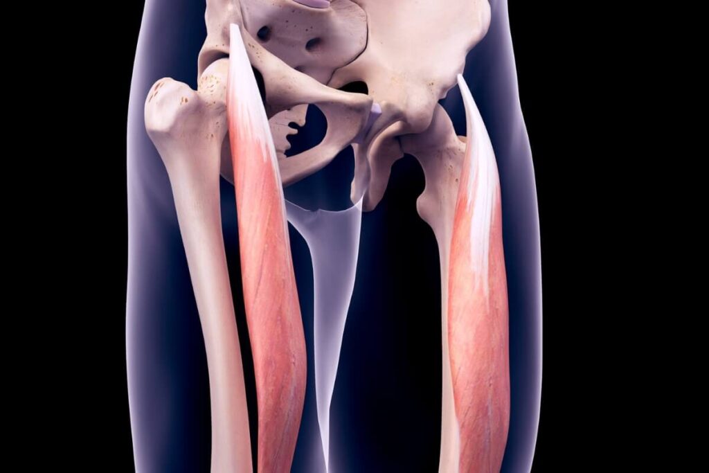 Rectus femoris tendinopathie